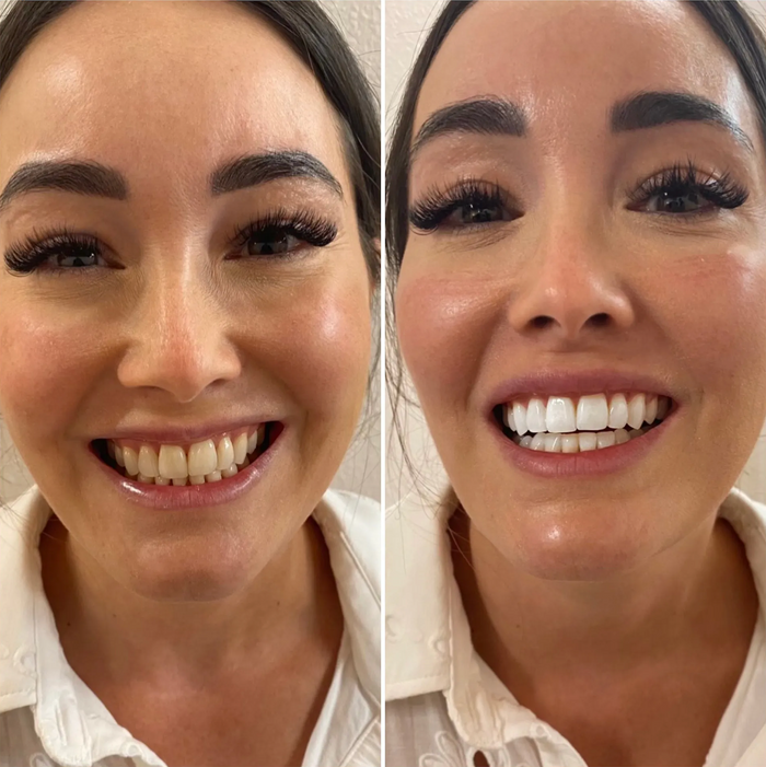 Side-by-side comparison of a woman's face with and without makeup, focusing on the eyes and smile.