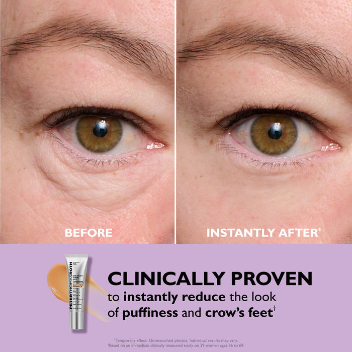 Before and after comparison of eye area with a cosmetic product tube labeled 'Clinically Proven'.