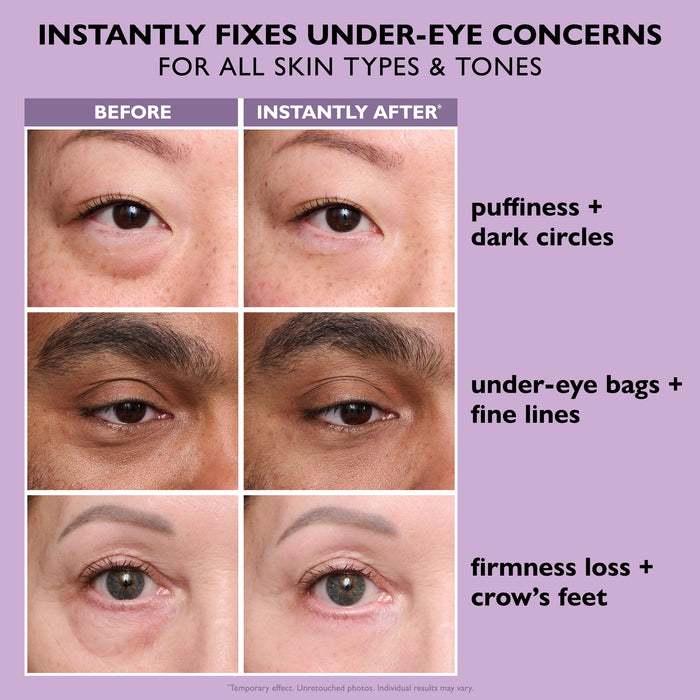 Before and after comparison of under-eye concerns with text on a purple background