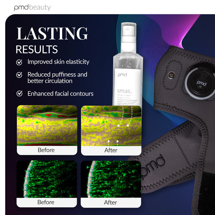 PMD Beauty SMAS. lifting spray bottle shown on a dark promotional graphic with text reading 'LASTING RESULTS' and before/after skin texture images.