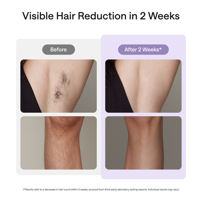 A before-and-after comparison graphic showing hair reduction on underarm and thigh areas, with the headline 'Visible Hair Reduction in 2 Weeks' and labels 'Before' and 'After 2 Weeks'.